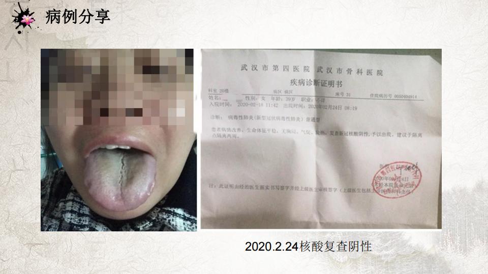 2021-5-4新冠肺炎课件（沈教授）正文_44.jpg